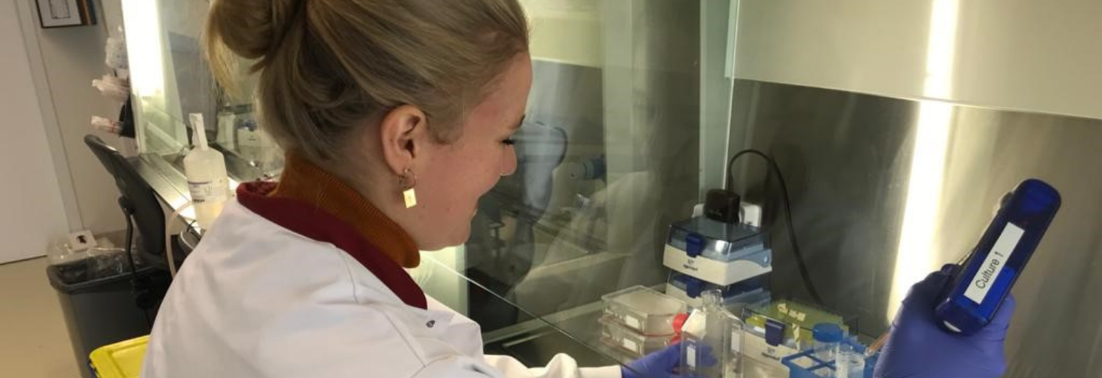 Britt netose brandwonden