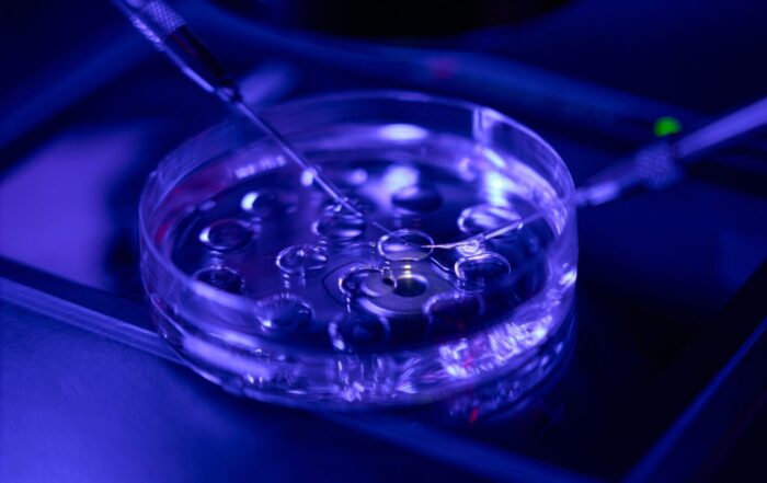 Afbeelding ter illustratie bij artikel over Mechpath